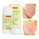 Смягчающая маска для стоп Purederm Moisturizing Heel Crack Remover 1095739445 фото 1